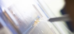 COVID-19 : quelles conséquences sur les globules blancs ?