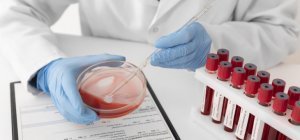 « Minuscule, les cancers à la loupe » à la Maison du don